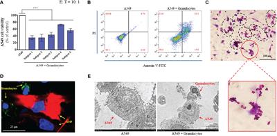 Ginsenoside Rg1 as a promising adjuvant agent for enhancing the anti-cancer functions of granulocytes inhibited by noradrenaline